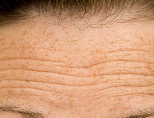 Trends in Neuromodulators: The Future of Anti-Wrinkle Treatments